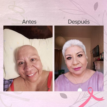 LA PÓCIMA DE RAPUNZEL KIT CLASICO