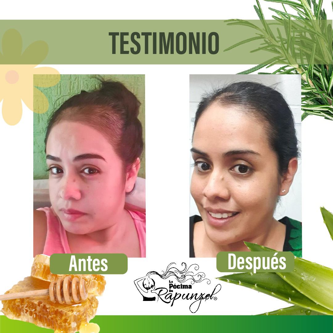 LA PÓCIMA DE RAPUNZEL KIT CLASICO